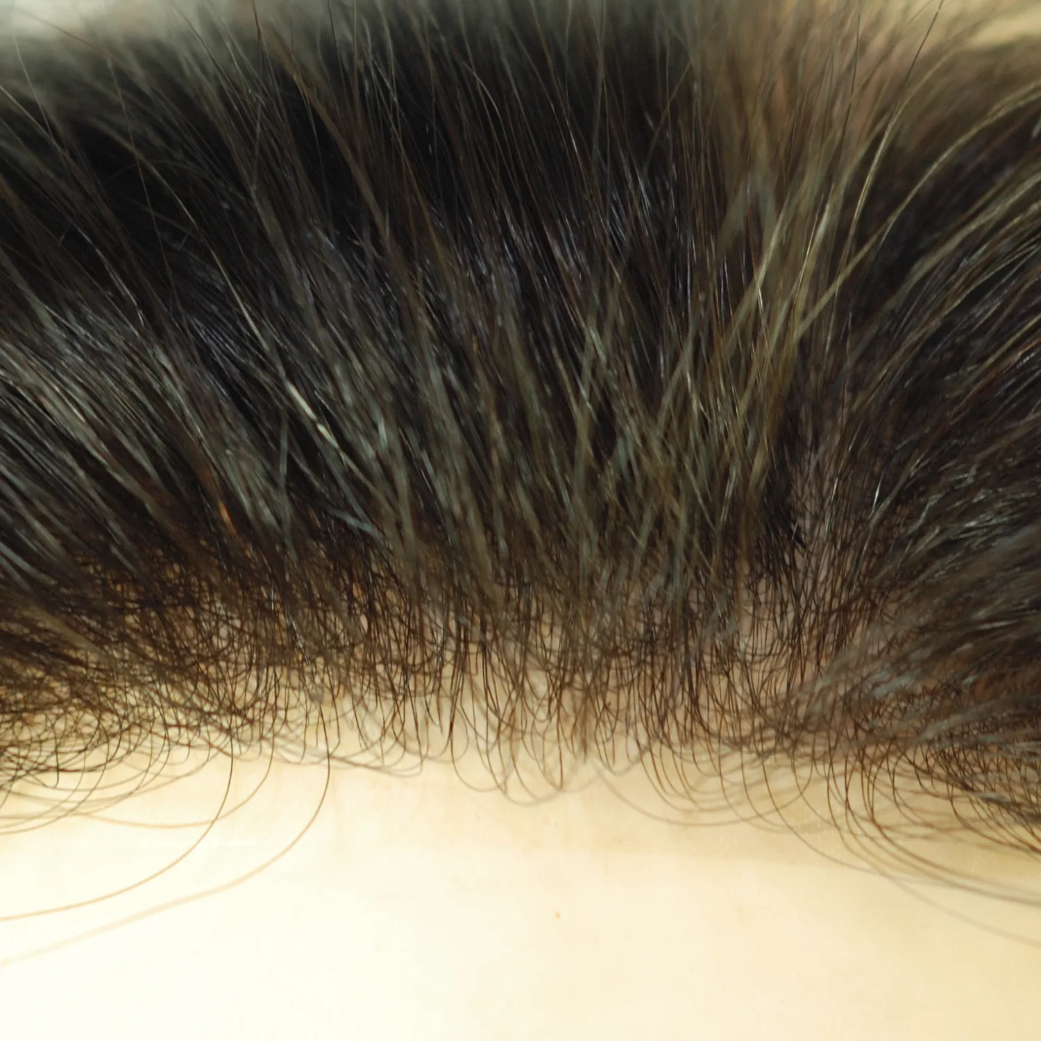 Hair Contacts - Bald Patch Seamless Blending