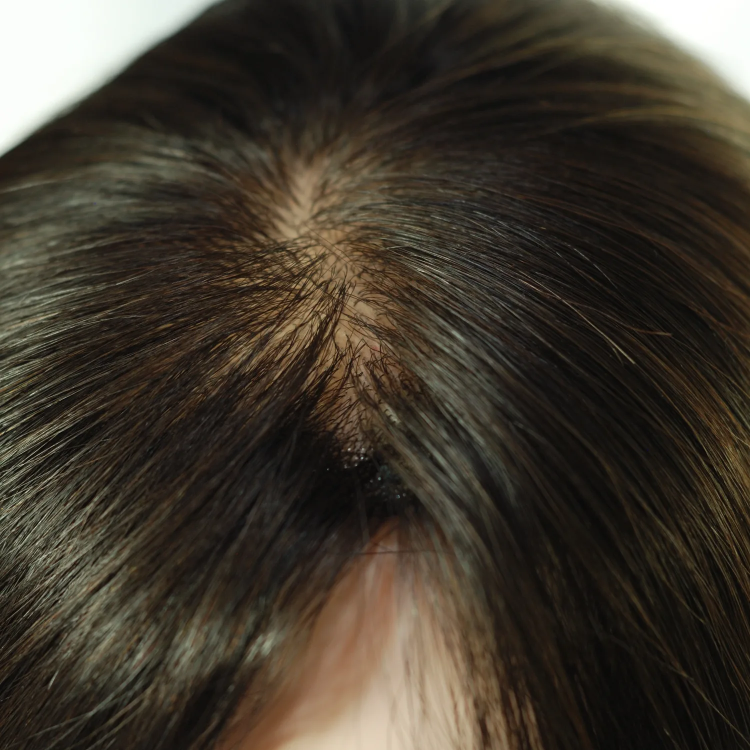 Hair Topper - Crown Volume Enhancement